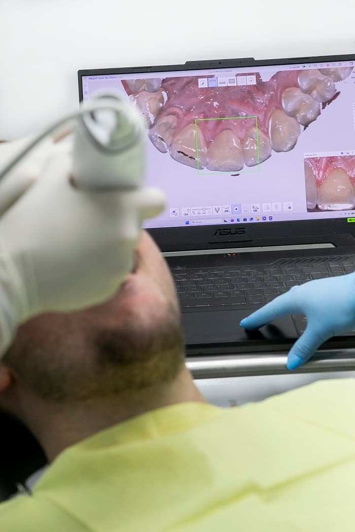 cadu sedación consciente dentista zaragoza